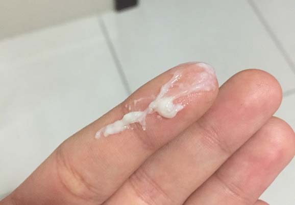 Какие выделения при беременности на ранних сроках (какая должна быть норма)