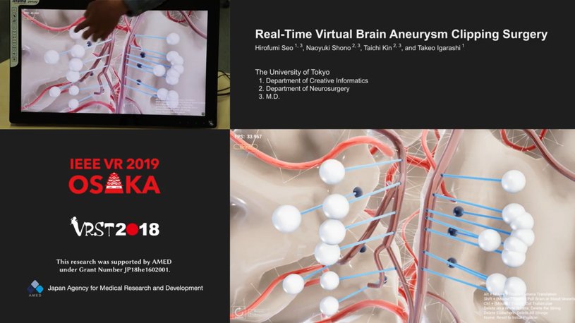 Применение игровому движку Unreal Engine найдено в нейрохирургии